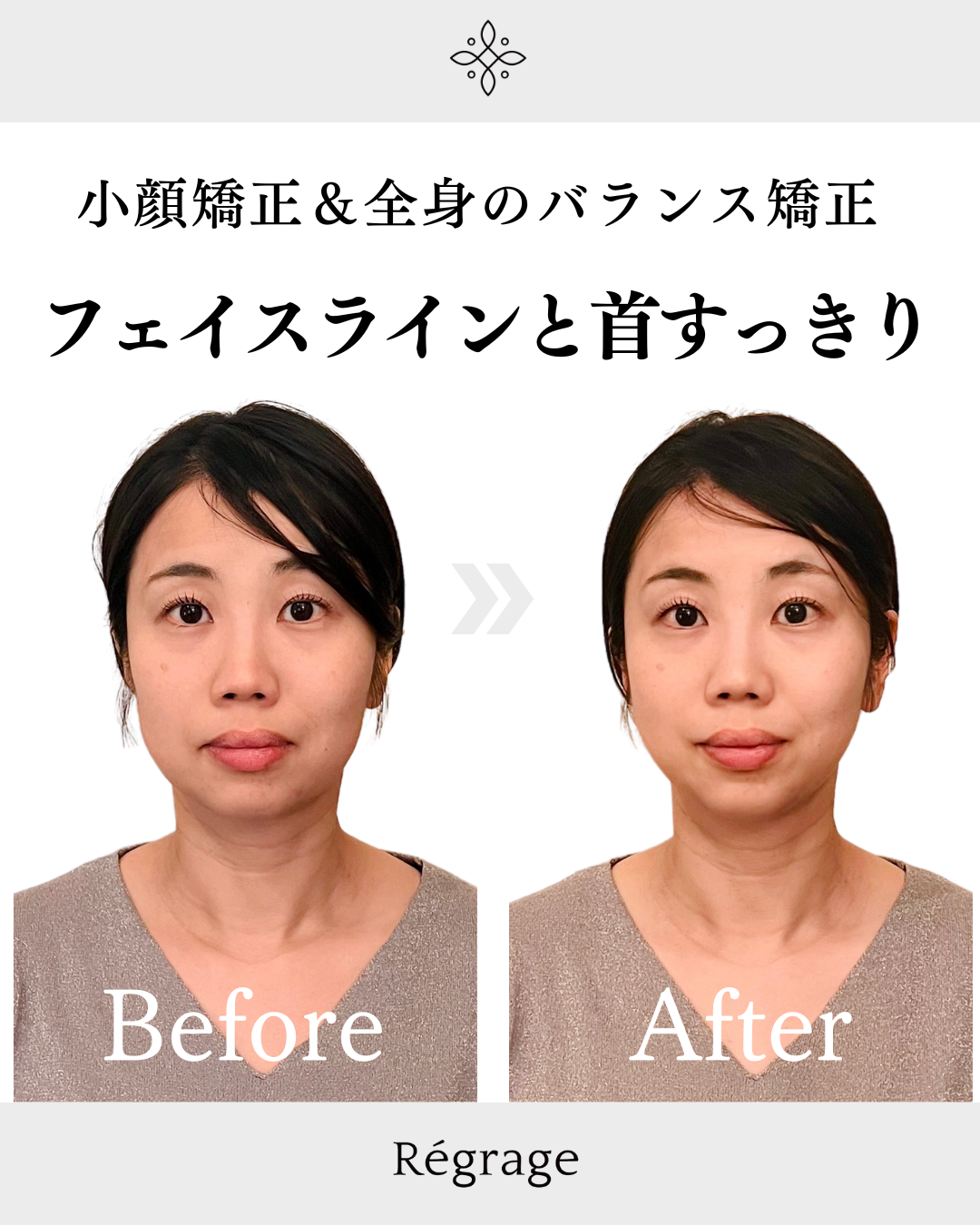 フェイスラインと首すっきり - 美容整体Regrage（リグラージュ）/ 若返り小顔矯正＆姿勢改善・たるみ、歪み、ほうれい線、二重あご、スマホ首、肩こり、首こりでのお悩みを根本改善