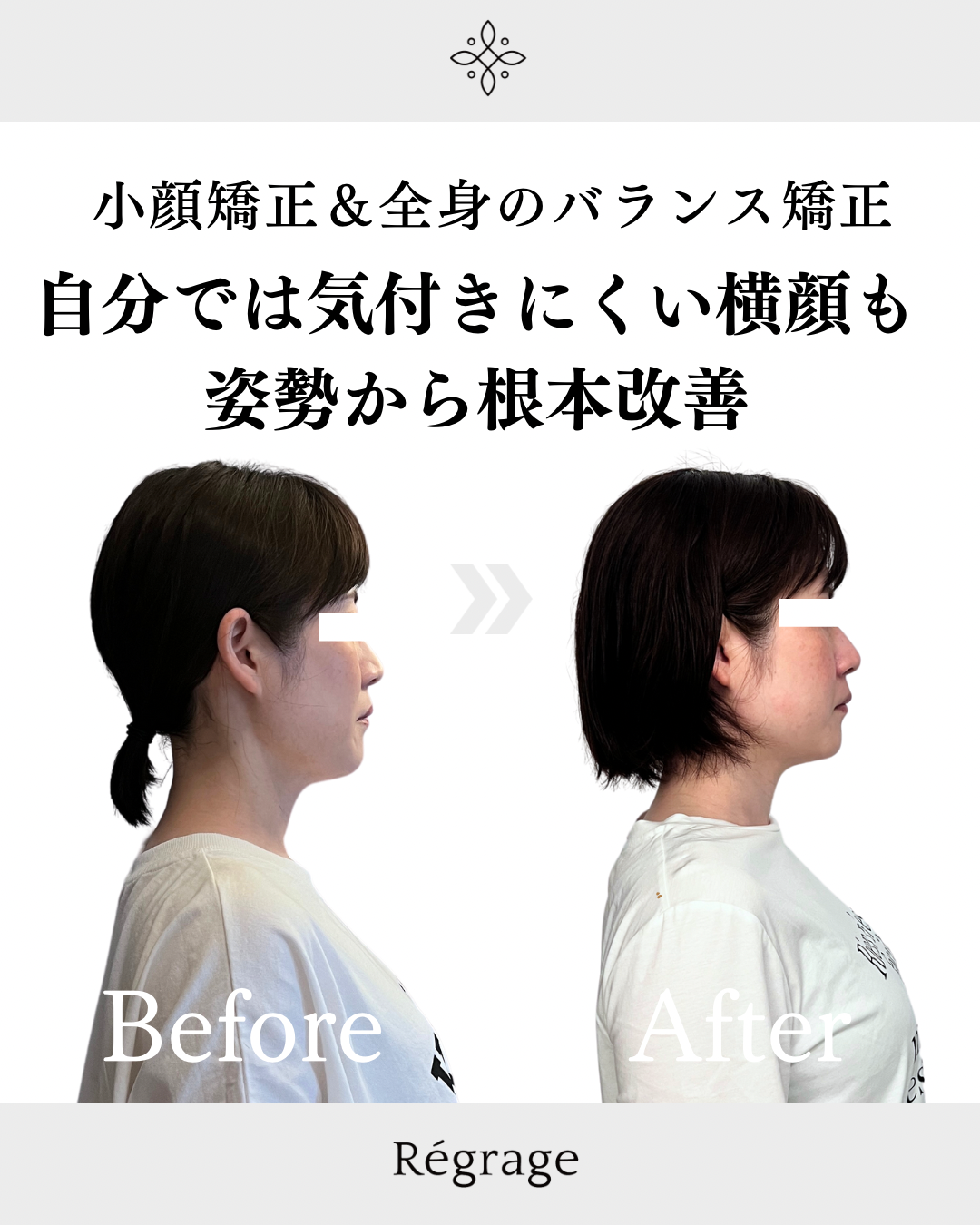 自分では気付きにくい横顔も姿勢から根本改善 - 美容整体Regrage（リグラージュ）/ 若返り小顔矯正＆姿勢改善・たるみ、歪み、ほうれい線、二重あご、スマホ首、肩こり、首こりでのお悩みを根本改善