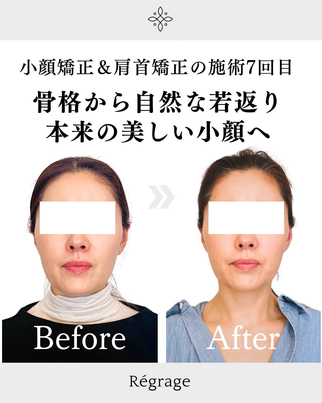 骨格から自然な若返り・本来の美しい小顔へ - 美容整体Regrage（リグラージュ）/ 若返り小顔矯正＆姿勢改善・たるみ、歪み、ほうれい線、二重あご、スマホ首、肩こり、首こりでのお悩みを根本改善