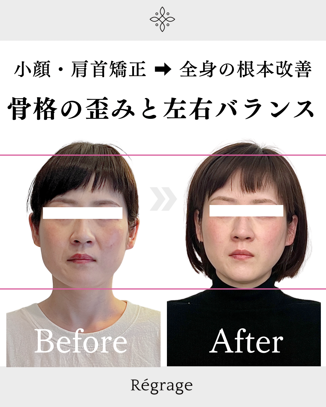 骨格の歪みと顔の左右バランス - 美容整体Regrage（リグラージュ）/ 若返り小顔矯正＆姿勢改善・たるみ、歪み、ほうれい線、二重あご、スマホ首、肩こり、首こりでのお悩みを根本改善