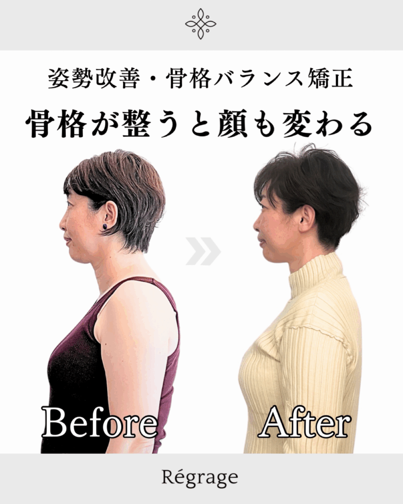 40代女性・骨格矯正で姿勢も顔も若々しく/ 福岡博多の小顔矯正＆姿勢改善 - 美容整体Regrage（リグラージュ）