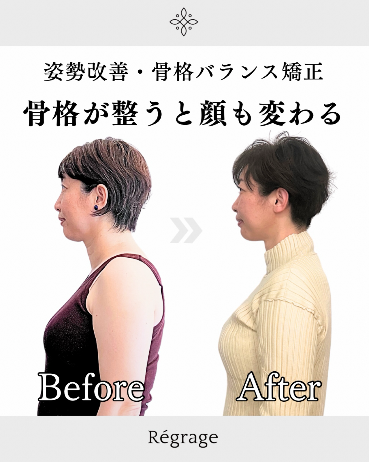 40代女性・骨格矯正で姿勢も顔も若々しく/ 福岡博多の小顔矯正＆姿勢改善 - 美容整体Regrage（リグラージュ）