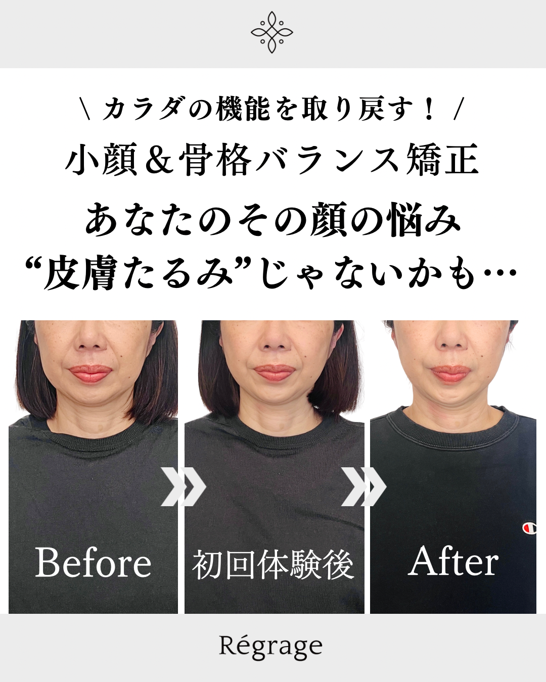 40代女性・顔のたるみを姿勢から根本改善/ 福岡博多の小顔矯正＆姿勢改善 - 美容整体Regrage（リグラージュ）