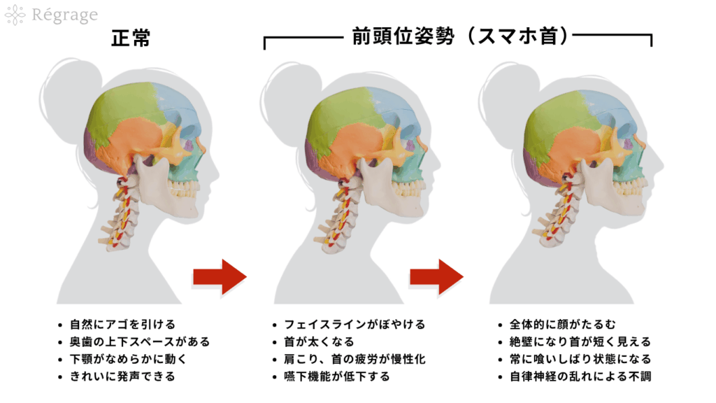 姿勢から見る老化のメカニズム- 顔の下垂・フェイスラインのぼやけ、アゴが引けない／首が前に出る → 顔が大きく見える、呼吸が浅くなる・疲れやすくなる・眠りが浅い などの全身症状も / 顔だけでなく身体全体を整える美容整体リグラージュでは、ストレートネック改善によるフェイスラインケアを行っております