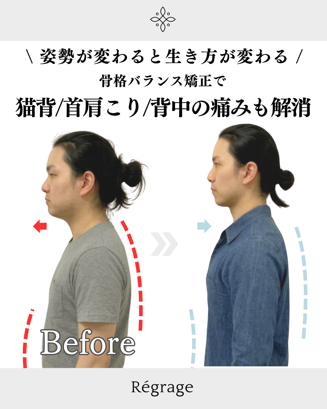 30代男性・不良姿勢を骨格矯正で改善！一気に垢抜け男前に/ 福岡博多の小顔矯正＆姿勢改善 - 美容整体Regrage（リグラージュ）