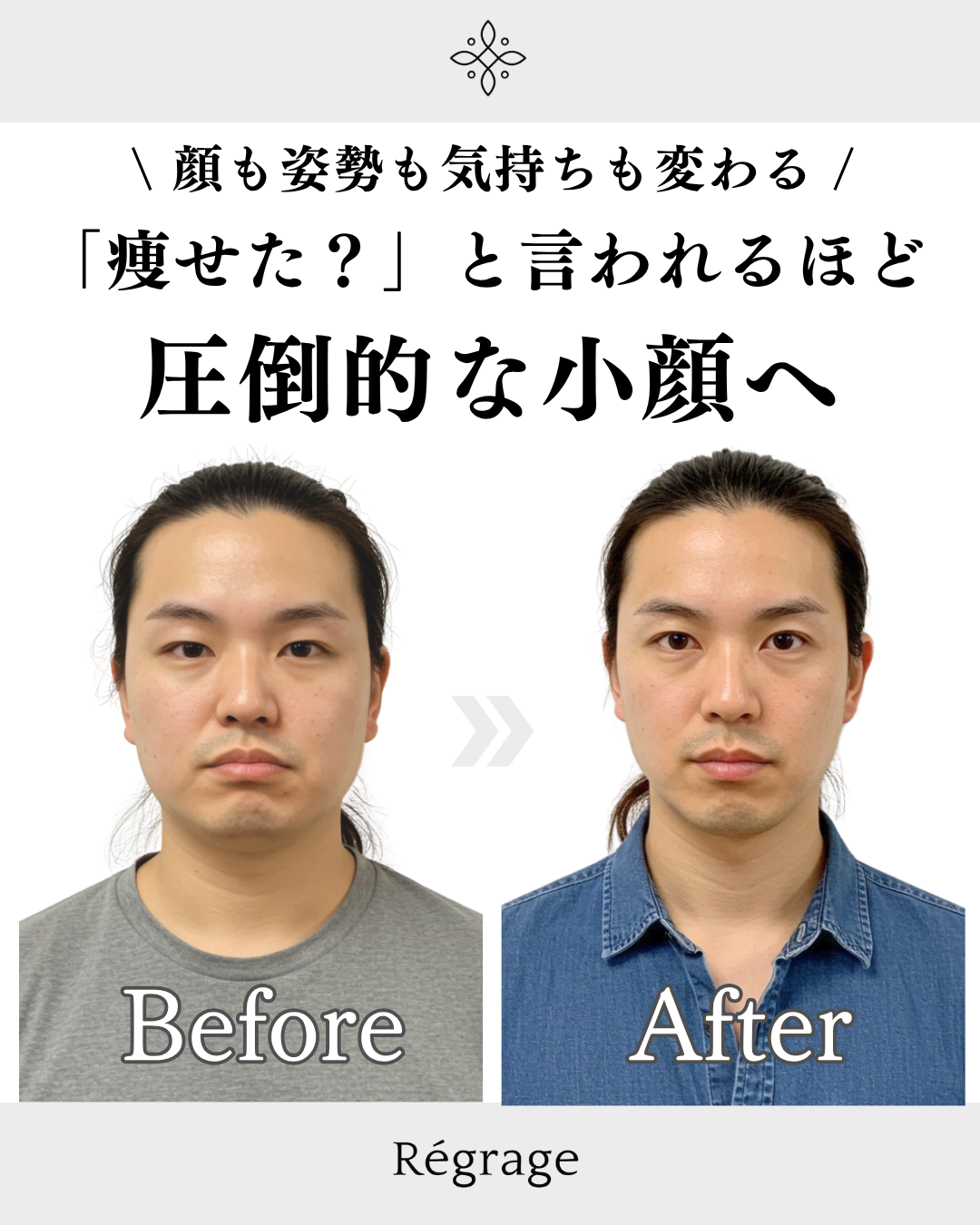 30代男性・不良姿勢を骨格矯正で改善！一気に垢抜け男前に/ 福岡博多の小顔矯正＆姿勢改善 - 美容整体Regrage（リグラージュ）